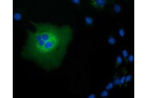 Anti-TCP11L2 mouse monoclonal antibody (ABIN2453717) immunofluorescent staining of COS7 cells transiently transfected by pCMV6-ENTRY TCP11L2 (RC207129). (TCP11L2 Antikörper)