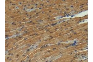 Detection of S100 in Mouse Heart Tissue using Polyclonal Antibody to S100 Calcium Binding Protein (S100) (S100 Protein (S100) (AA 2-94) Antikörper)
