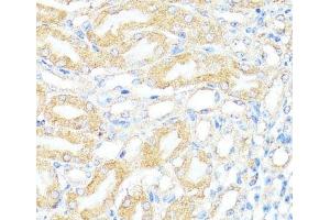 Immunohistochemistry of paraffin-embedded Mouse kidney using BAX Polyclonal Antibody at dilution of 1:100 (40x lens). (BAX Antikörper)