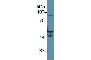 Western Blotting (WB) image for Keratin 16 (KRT16) ELISA Kit (ABIN6720452)