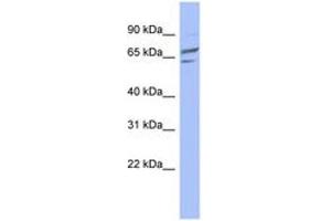Image no. 1 for anti-Phosphoglucomutase 1 (PGM1) (C-Term) antibody (ABIN6744067) (Phosphoglucomutase 1 Antikörper  (C-Term))