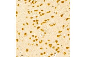 Immunohistochemistry of paraffin embedded mouse brain using BPTF (ABIN7073234) at dilution of 1:500 (400x lens) (BPTF Antikörper)