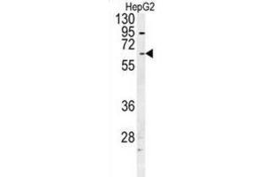 Western Blotting (WB) image for anti-UDP Glucuronosyltransferase 1 Family, Polypeptide A1 (UGT1A1) antibody (ABIN2997636) (UGT1A1 Antikörper)