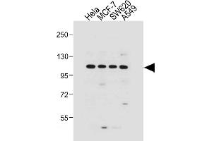 All lanes : Anti-G Antibody (N-term) at 1:1000 dilution Lane 1: Hela whole cell lysate Lane 2: MCF-7 whole cell lysate Lane 3: S whole cell lysate Lane 4: A549 whole cell lysate Lysates/proteins at 20 μg per lane. (GAA Antikörper  (N-Term))