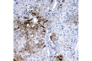 IHC analysis of GSTA1/A2/A3/A4/A5 using anti-GSTA1/A2/A3/A4/A5 antibody (ABIN5518995).