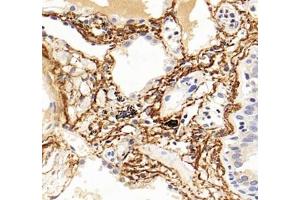 Immunohistochemistry analysis of paraffin-embedded human lung using,MFAP4 (ABIN7074614) at dilution of 1: 2000 (MFAP4 Antikörper)