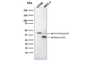 Western Blot Analysis of human liver tissue and MCF-7 cell lysates usingCathepsin D Mouse Monoclonal Antibody (CTSD/2781). (Cathepsin D Antikörper  (AA 104-250))
