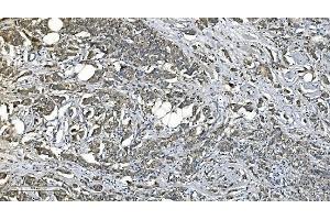 IHC analysis of PNPT1 using anti-PNPT1 antibody (ABIN7599172). (PNPT1 Antikörper  (AA 1-257))