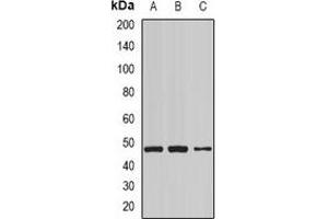 Western blot analysis of NCK1 expression in Hela (A), mouse lung (B), mouse brain (C) whole cell lysates. (NCK1 Antikörper)
