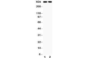 Western blot testing of p300 antibody and Lane 1:  human COLO320;  2: rat PC12 lysate; Predicted/observed size ~300KD