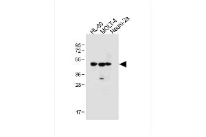 All lanes : Anti-BLMH Antibody (Center) at 1:1000 dilution Lane 1: HL-60 whole cell lysate Lane 2: MOLT-4 whole cell lysate Lane 3: Neuro-2a whole cell lysate Lysates/proteins at 20 μg per lane. (BLMH Antikörper  (AA 212-242))