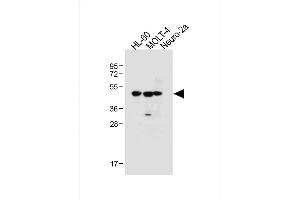 All lanes : Anti-BLMH Antibody (Center) at 1:1000 dilution Lane 1: HL-60 whole cell lysate Lane 2: MOLT-4 whole cell lysate Lane 3: Neuro-2a whole cell lysate Lysates/proteins at 20 μg per lane. (BLMH Antikörper  (AA 212-242))
