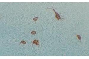 Immunohistochemical staining using MAb-Ad-H-2 antibody on Adenovirus AV2 infected Hela cells (Human Adenovirus Hexon (HAdV Hexon) Antikörper)