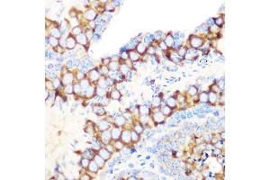 Immunohistochemistry of paraffin-embedded mouse testis using RUVBL1/TIP49A/PONTIN Rabbit mAb (ABIN7270118) at dilution of 1:100 (40x lens). (RUVBL1 Antikörper)