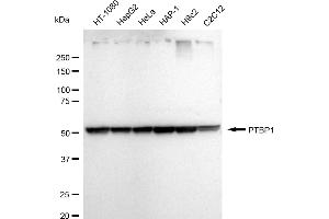 Western blotting analysis using PTBP1 antibody (ABIN7799882). (Rekombinanter PTBP1 Antikörper)