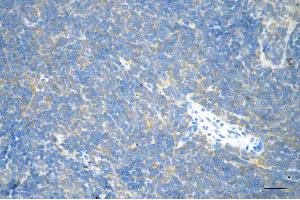Immunohistochemistry was performed on paraffin-embedded mouse spleen using RHOA antibody (ABIN7800142), 1:200). (Rekombinanter RHOA Antikörper)