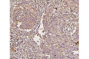 IHC analysis of IRS1 using anti-IRS1 antibody (ABIN7599659). (IRS1 Antikörper  (AA 1041-1242))