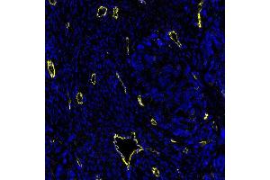 Immunofluorescence (IF) image for anti-Cadherin 5 (CDH5) (AA 48-599) antibody (ABIN7455190) (Rekombinanter Cadherin 5 Antikörper  (AA 48-599))
