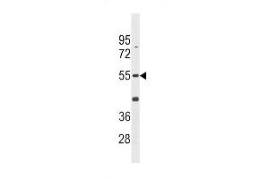 Western blot analysis in K562 cell line lysates (35ug/lane). (CDK14 Antikörper  (N-Term))