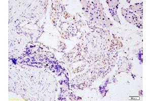 Immunohistochemistry (Paraffin-embedded Sections) (IHC (p)) image for anti-Tumor Necrosis Factor alpha (TNF alpha) (AA 181-235) antibody (ABIN677318)