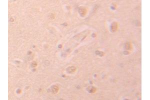Used in DAB staining on fromalin fixed paraffin-embedded Heart tissue (PHPT1 Antikörper  (AA 1-125))