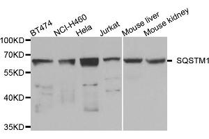 Western blot analysis of extracts of various cell lines, using SQSTM1 antibody (ABIN5975634) at 1/1000 dilution. (SQSTM1 Antikörper)