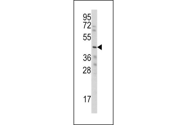 WISP3 Antikörper  (AA 305-335)