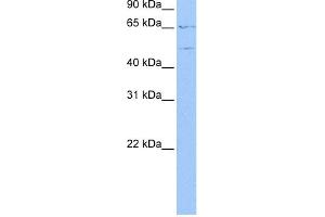 WB Suggested Anti-WASF3 Antibody Titration: 0. (WASF3 Antikörper  (N-Term))