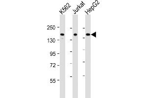 All lanes : Anti-IQSEC2 Antibody (Center) at 1:2000 dilution Lane 1: K562 whole cell lysates Lane 2: Jurkat whole cell lysates Lane 3: HepG2 whole cell lysates Lysates/proteins at 20 μg per lane.