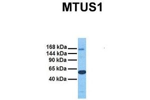 Western Blotting (WB) image for anti-Microtubule Associated Tumor Suppressor 1 (MTUS1) (Middle Region) antibody (ABIN2781855)