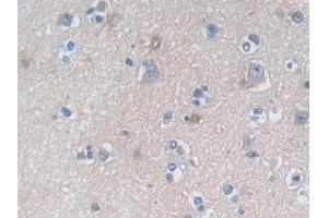 Immunohistochemistry (IHC) image for anti-Dimethylarginine Dimethylaminohydrolase 1 (DDAH1) (AA 20-215) antibody (ABIN7435685)