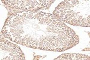 Immunohistochemistry (Paraffin-embedded Sections) (IHC (p)) image for anti-NCK Associated Protein 1 (NCKAP1) antibody (ABIN7074784)