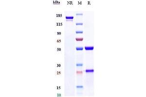 Anti-SLC1A5 / ASCT2 Reference Antibody (idactamab) on SDS-PAGE under reducing (R) condition.