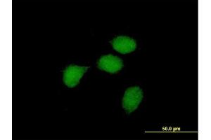 Immunofluorescence of purified MaxPab antibody to BCL3 on HeLa cell.
