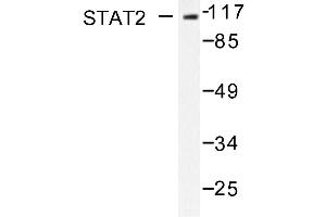 Image no. 1 for anti-Signal Transducer and Activator of Transcription 2, 113kDa (STAT2) antibody (ABIN271825) (STAT2 Antikörper)