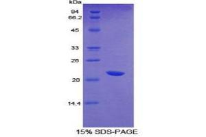 SDS-PAGE (SDS) image for CD36 (CD36) (AA 45-203) protein (His tag,T7 tag) (ABIN1879477)