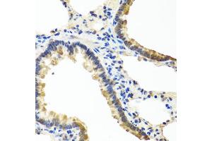 Immunohistochemistry of paraffin-embedded rat lung using ANGPT1 antibody (ABIN5974767) at dilution of 1/100 (40x lens).