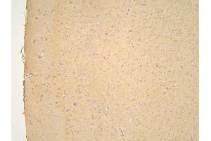 IHC analysis of PPA1 using anti-PPA1 antibody (ABIN6719527).