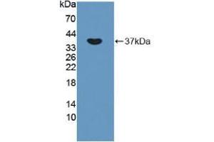 Western blot analysis of recombinant Rat OXTR. (Oxytocin Receptor Antikörper  (AA 43-129))