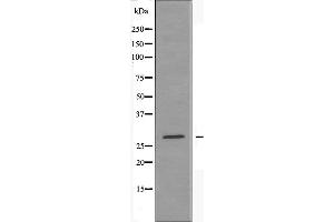 Western blot analysis of extracts from rat brain cells, using ANP32B antibody. (ANP32B Antikörper)