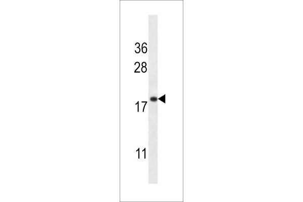 Transmembrane Protein 70 (TMM70) (AA 231-260), (C-Term) antibody
