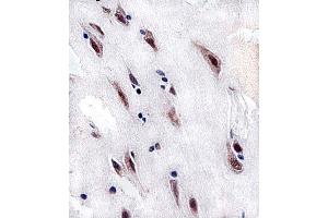 Immunohistochemistry (Paraffin-embedded Sections) (IHC (p)) image for anti-Casein Kinase 2 alpha 1 (CSNK2A1) (AA 250-284) antibody (ABIN1944742)
