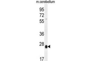 Western Blotting (WB) image for anti-Scleraxis (SCXA) antibody (ABIN5015284)