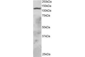 ABIN184814 staining (2µg/ml) of HepG2 lysate (RIPA buffer, 30µg total protein per lane). (RNF31 Antikörper  (C-Term))