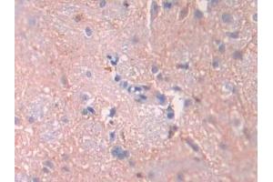 Immunohistochemistry (IHC) image for anti-Interleukin 1 Receptor, Type I (IL1R1) (AA 119-217) antibody (ABIN7430741)