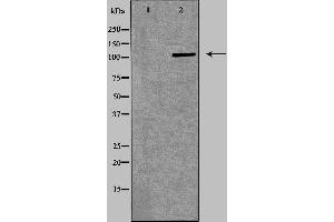 Western blot analysis of Jurkat  lysate using ITGA4 antibody. (ITGA4 Antikörper  (C-Term))