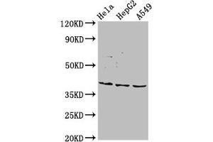 Western Blot Positive WB detected in: Hela whole cell lysate, HepG2 whole cell lysate, A549 whole cell lysate All lanes: NANS antibody at 5. (NANS Antikörper  (AA 132-259))