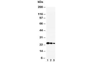 Western blot testing of IL-6 antibody and recombinant human protein: (1) 10ng, (2) 5ng, (3) 2.