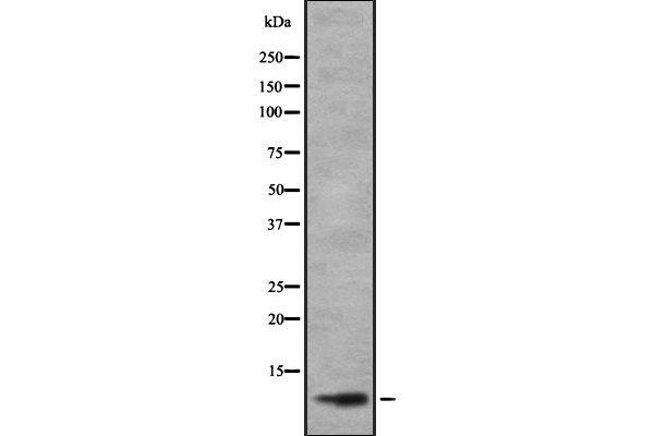 TAL2 Antikörper  (C-Term)