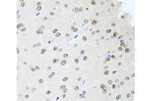 Immunohistochemistry of paraffin-embedded Rat brain using SAP18 Polyclonal Antibody at dilution of 1:100 (40x lens).